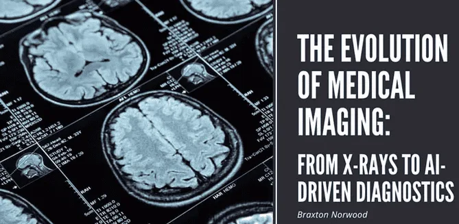 brain scan and article title